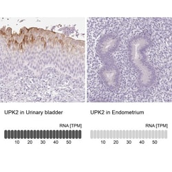 Uroplakin II Antibody, Novus Biologicals 25 &mu;L, Unlabeled:Antibodies,